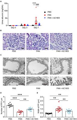 TRPC5 Channel Inhibition Protects Podocytes in Puromycin-Aminonucleoside Induced Nephrosis Models